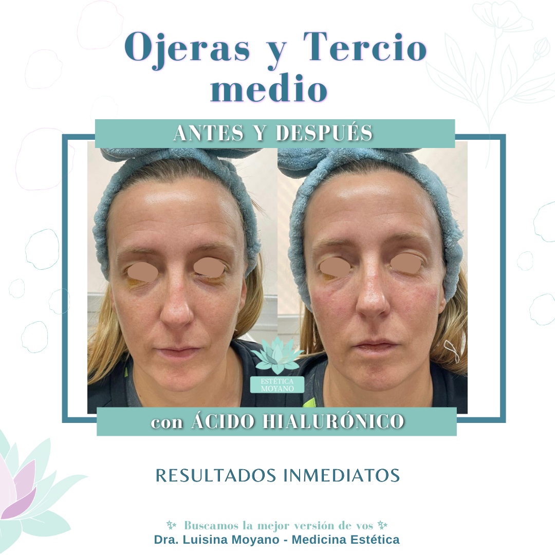 Dra. Luisina Moyano - Medicina Estética